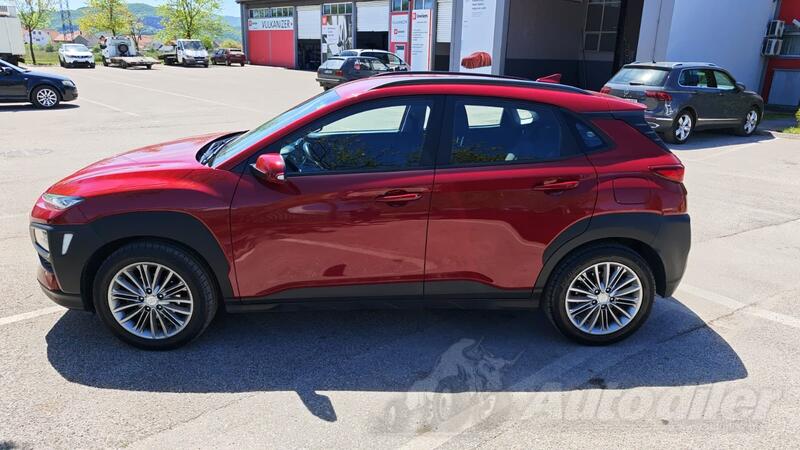 Hyundai - Kona - 1.6 CRDI